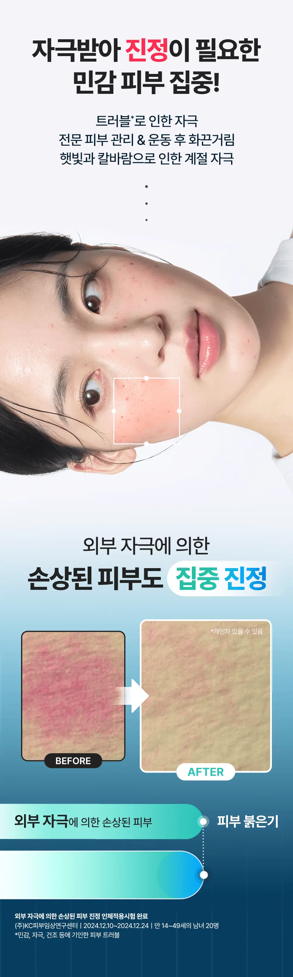 [NEW/즉각수분쿨링] 레드 블레미쉬 히알 시카 쿨링 겔 마스크 1매 상세페이지 19